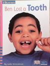 Ben Lost a Tooth | 9999903333296 | Leslie Kimmelman